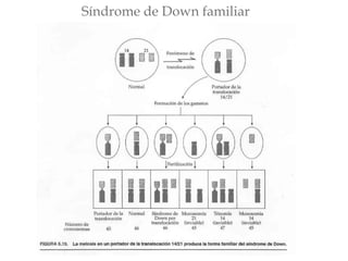 Síndrome de Down familiar 