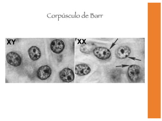 Corpúsculo de Barr 