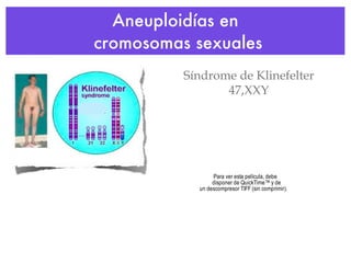 Aneuploidías en  cromosomas sexuales Síndrome de Klinefelter 47,XXY 