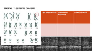IDENTIFICO EL SIGUIENTES CARIOTIPOS
Tipo de deleccion Nombre del
síndrome
Cuadro clínico
 