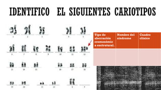 IDENTIFICO EL SIGUIENTES CARIOTIPOS
Tipo de
aberración
cromosómic
a esctrutural.
Nombre del
síndrome
Cuadro
clínico
 