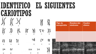 IDENTIFICO EL SIGUIENTES
CARIOTIPOS
Tipo de
aneuploidia
Nombre del
síndrome
Cuadro
clínico
 