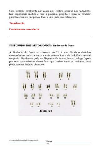 www.poethaabiliomachado.blogspot.com.br
Página
10
Uma inversão geralmente não causa um fenótipo anormal nos portadores.
Sua importância médica é para a progênie, pois há o risco de produzir
gametas anormais que podem levar a uma prole não-balanceada.
Translocação
Cromossomos marcadores
DISTÚRBIOS DOS AUTOSSOMOS - Síndrome de Down
A Sindrome de Down ou trissomia do 21, é sem dúvida o distúrbio
cromossômico mais comum e a mais comum forma de deficiência mental
congênita. Geralmente pode ser diagnosticada ao nascimento ou logo depois
por suas características dismórficas, que variam entre os pacientes, mas
produzem um fenótipo distintivo.
 