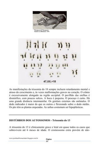 www.poethaabiliomachado.blogspot.com.br
Página
23
As manifestações da trissomia do 18 sempre incluem retardamento mental e
atraso do crescimento e, às vezes malformações graves no coração. O crânio
é excessivamente alongado na região occipital. O pavilhão das orelhas é
dismórfico, com poucos sulcos. A boca é pequena. O pescoço é curto. Há
uma grande distância intermamilar. Os genitais externos são anômalos. O
dedo indicador é maior do que os outros e flexionado sobre o dedo médio.
Os pés têm as plantas arqueadas. As unhas costumam ser hipoplásticas.
DISTÚRBIOS DOS AUTOSSOMOS - Trissomia do 13
A trissomia do 13 é clinicamente grave e letal em quase todos os casos que
sobrevivem até 6 meses de idade. O cromossomo extra provém de não-
 