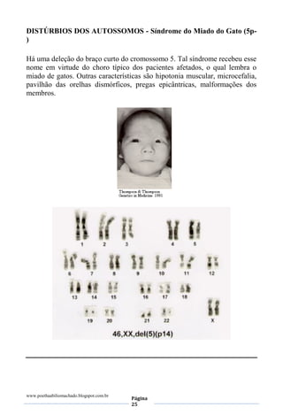www.poethaabiliomachado.blogspot.com.br
Página
25
DISTÚRBIOS DOS AUTOSSOMOS - Síndrome do Miado do Gato (5p-
)
Há uma deleção do braço curto do cromossomo 5. Tal síndrome recebeu esse
nome em virtude do choro típico dos pacientes afetados, o qual lembra o
miado de gatos. Outras características são hipotonia muscular, microcefalia,
pavilhão das orelhas dismórficos, pregas epicântricas, malformações dos
membros.
 
