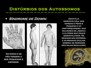Distúrbios dos Autossomos   Síndrome de Down:   Genitália desenvolvida; nos homens o pênis é pequeno e há criptorquidismo, nas mulheres os lábios e o clitóris são pouco desenvolvidos. Os meninos são estéreis, e as meninas ovulam, embora os períodos não sejam regulares.  As mãos e os pés tendem a ser pequenos e grossos  
