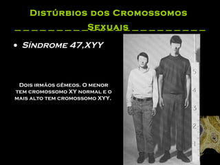 Distúrbios dos Cromossomos  Sexuais   Síndrome 47,XYY Dois irmãos gêmeos. O menor tem cromossomo XY normal e o mais alto tem cromossomo XYY.  
