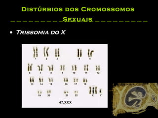 Distúrbios dos Cromossomos  Sexuais   Trissomia do X  