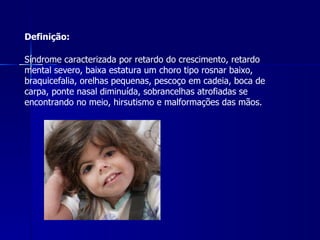 Síndrome caracterizada por retardo do crescimento, retardo mental severo, baixa estatura um choro tipo rosnar baixo, braquicefalia, orelhas pequenas, pescoço em cadeia, boca de carpa, ponte nasal diminuída, sobrancelhas atrofiadas se encontrando no meio, hirsutismo e malformações das mãos.   Definição: 