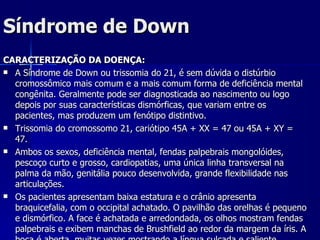 Síndrome de Down CARACTERIZAÇÃO DA DOENÇA: A Síndrome de Down ou trissomia do 21, é sem dúvida o distúrbio cromossômico mais comum e a mais comum forma de deficiência mental congênita. Geralmente pode ser diagnosticada ao nascimento ou logo depois por suas características dismórficas, que variam entre os pacientes, mas produzem um fenótipo distintivo. Trissomia do cromossomo 21, cariótipo 45A + XX = 47 ou 45A + XY = 47.  Ambos os sexos, deficiência mental, fendas palpebrais mongolóides, pescoço curto e grosso, cardiopatias, uma única linha transversal na palma da mão, genitália pouco desenvolvida, grande flexibilidade nas articulações.  Os pacientes apresentam baixa estatura e o crânio apresenta braquicefalia, com o occipital achatado. O pavilhão das orelhas é pequeno e dismórfico. A face é achatada e arredondada, os olhos mostram fendas palpebrais e exibem manchas de Brushfield ao redor da margem da íris. A boca é aberta, muitas vezes mostrando a língua sulcada e saliente. 