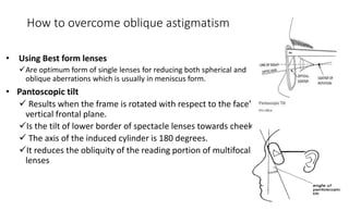 How to overcome oblique astigmatism
• Using Best form lenses
Are optimum form of single lenses for reducing both spherical and
oblique aberrations which is usually in meniscus form.
• Pantoscopic tilt
 Results when the frame is rotated with respect to the face’s
vertical frontal plane.
Is the tilt of lower border of spectacle lenses towards cheek
 The axis of the induced cylinder is 180 degrees.
It reduces the obliquity of the reading portion of multifocal
lenses
18
 