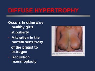 DIFFUSE HYPERTROPHY
Occurs in otherwise
  healthy girls
  at puberty
 Alteration in the
  normal sensitivity
  of the breast to
  estrogen
 Reduction
  mammoplasty
 