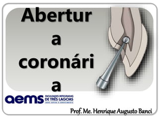 Abertur
a
coronári
a
Prof. Me. Henrique AugustoBanci
 
