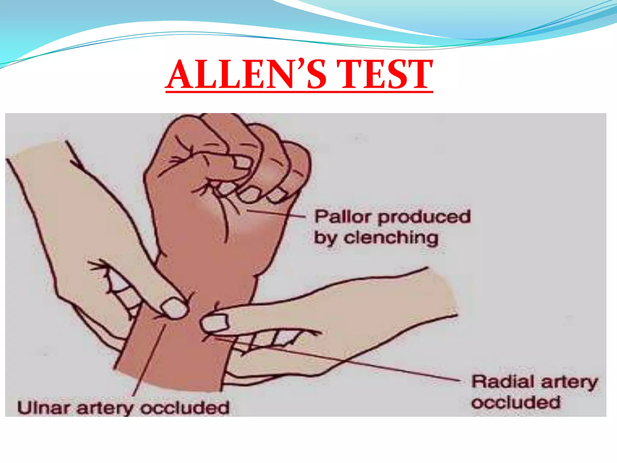 ALLEN’S TEST