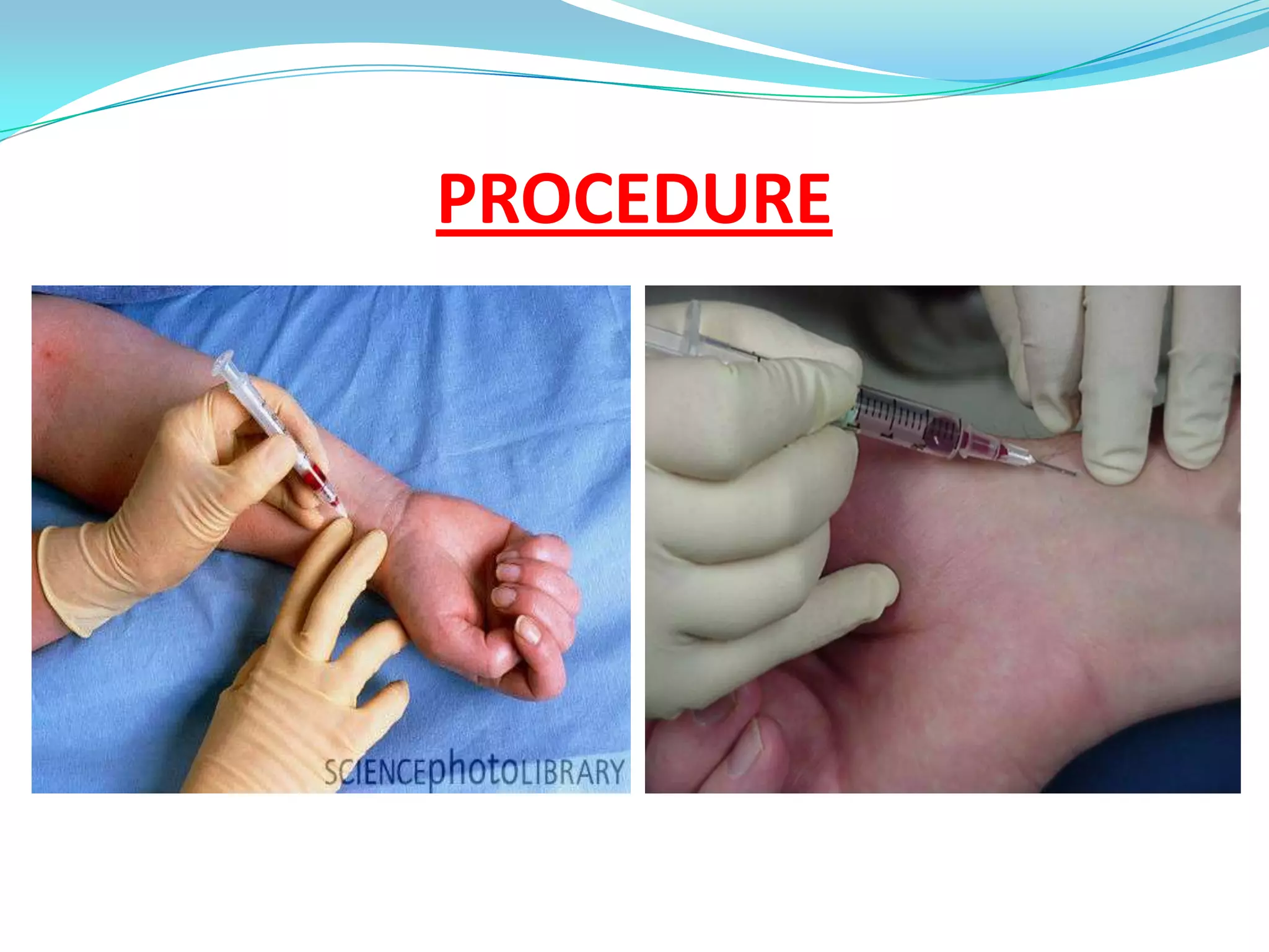PROCEDURE