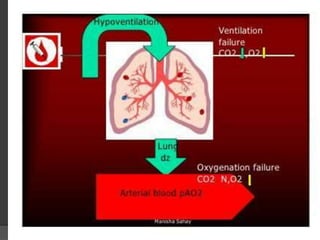 Arterial blood gas analysis | PPTX