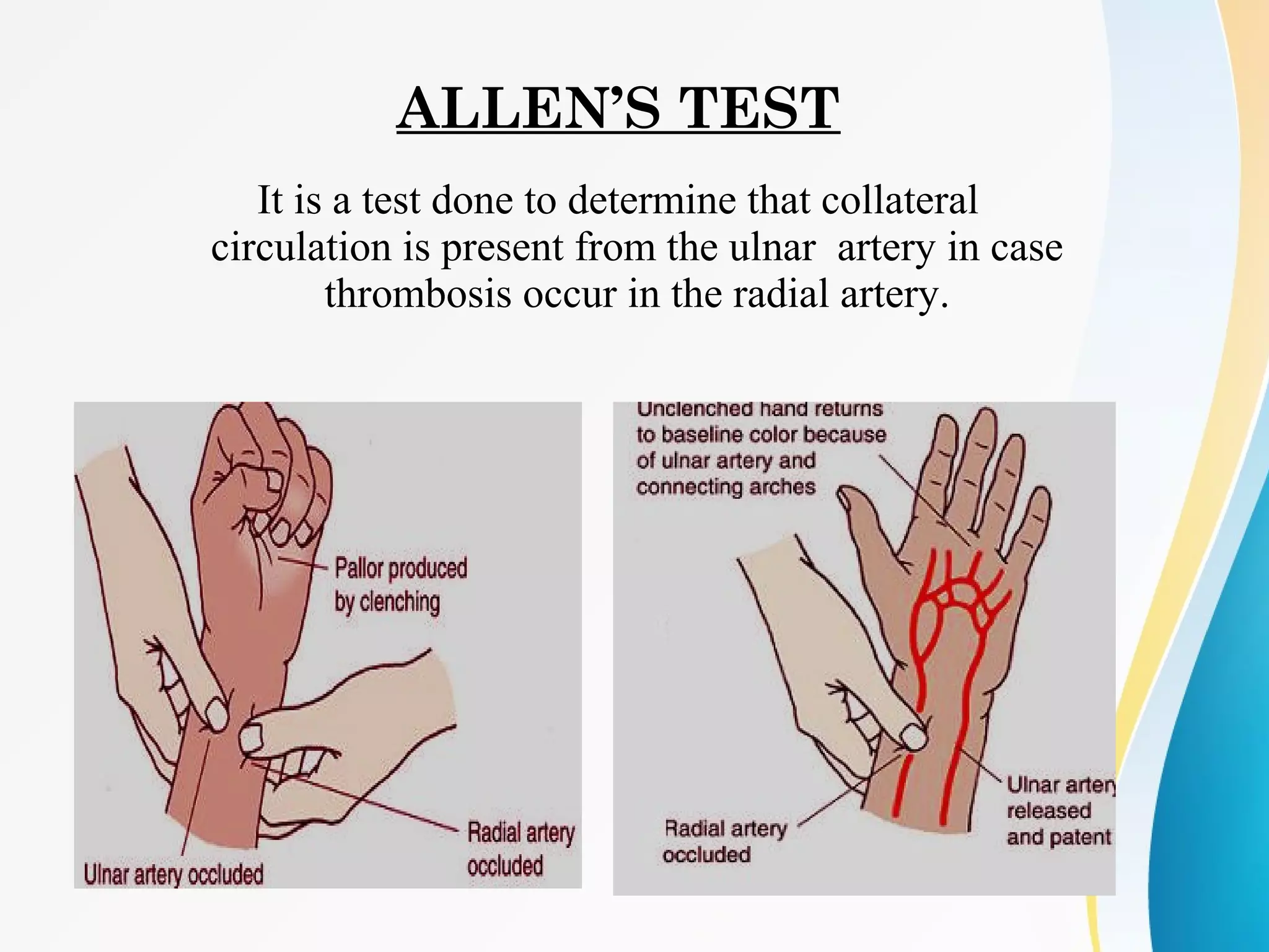 ALLEN’S TEST
It is a test done to determine that collateral
circulation is present from the ulnar artery in case
thrombosis occur in the radial artery.
 