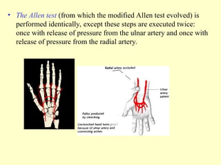• The Allen test (from which the modified Allen test evolved) is
performed identically, except these steps are executed twice:
once with release of pressure from the ulnar artery and once with
release of pressure from the radial artery.
 