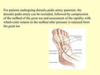 For patients undergoing dorsalis pedis artery puncture, the
dorsalis pedis artery can be occluded, followed by compression
of the nailbed of the great toe and assessment of the rapidity with
which color returns to the nailbed after pressure is released from
the great toe
 