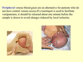 Peripheral venous blood gases are an alternative for patients who do
not have central venous access.If a tourniquet is used to facilitate
venipuncture, it should be released about one minute before the
sample is drawn to avoid changes induced by local ischemia.
 