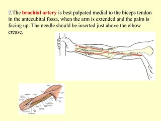 2.The brachial artery is best palpated medial to the biceps tendon
in the antecubital fossa, when the arm is extended and the palm is
facing up. The needle should be inserted just above the elbow
crease.
 