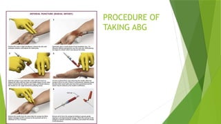 ABG analysis and nursing management pptx | PPTX