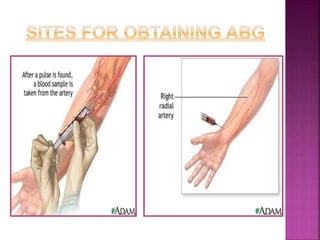 ABG ANALYSIS AND INTERPRETATION .pptx