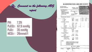 Q. Comment on the following ABG
report
PH: 7.29
PaCO2: 67.9 mmHg
PaO2: 35 mmHg
HCO3 : 26mmol/l
 
