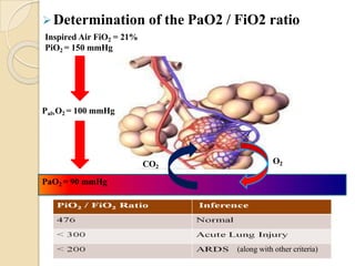 Determination of the PaO2 / FiO2 ratio
Inspired Air FiO2 = 21%
PiO2 = 150 mmHg
PalvO2 = 100 mmHg
PaO2 = 90 mmHg
O2
CO2
(along with other criteria)
 
