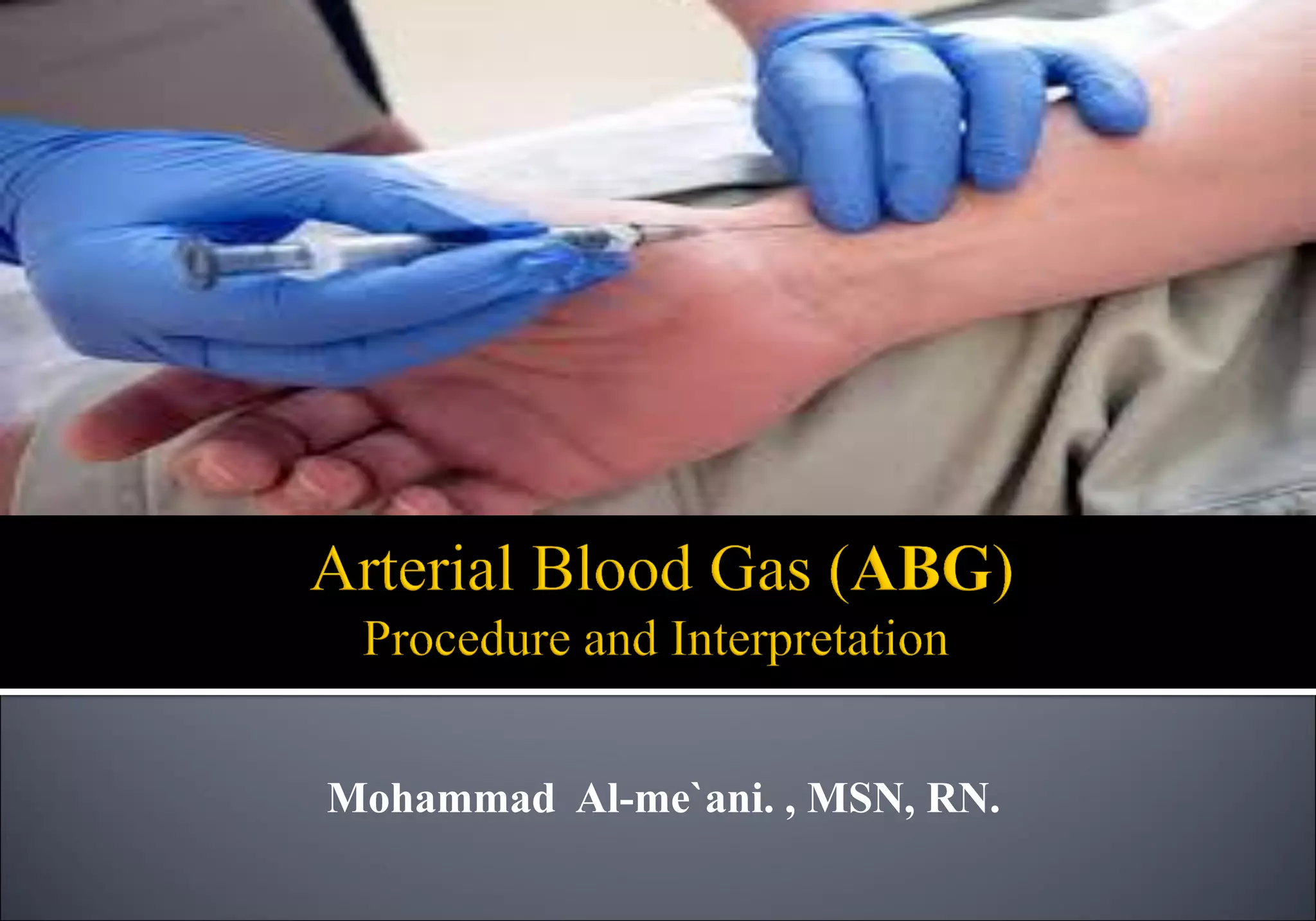 How To Get Arterial Blood Gas