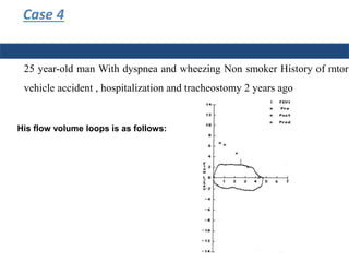25 year-old man With dyspnea and wheezing Non smoker History of mtor
vehicle accident , hospitalization and tracheostomy 2 years ago
Case 4
His flow volume loops is as follows:
 