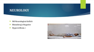 cervical myelopathy case presentation .pptx