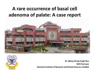 A rare occurrence of basal cell
adenoma of palate: A case report
Dr. Abhay Partap Singh Brar
BDS Final year
Dasmesh Institute of Research and Dental Sciences, Faridkot
 