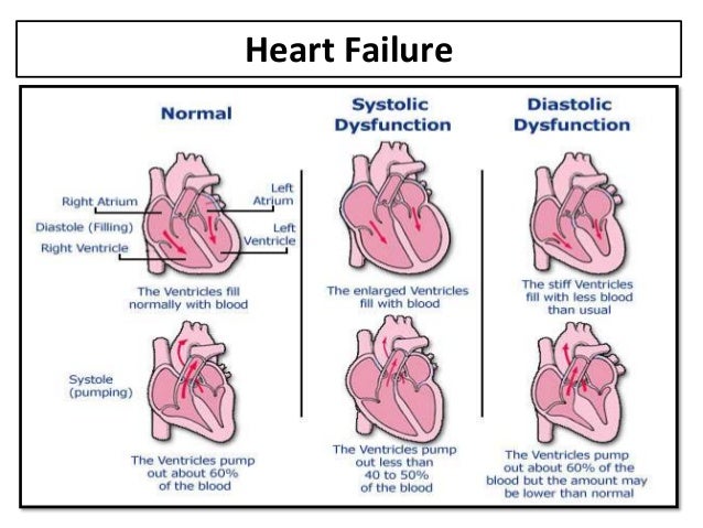 a research on congestive heart failure Related essays: congestive heart failure is a serious problem congestive heart failure is a serious problem for many individuals in this country. a research on congestive heart failure Related essays: congestive heart failure is a serious problem congestive heart failure is a serious problem for many individuals in this country.