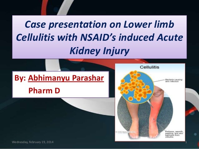 acute kidney injury case study slideshare