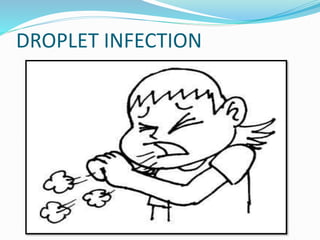 DROPLET INFECTION
 