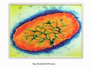 Fig: Bordetella Pertusis
 