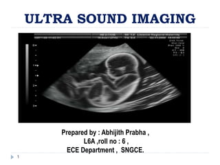 ULTRA SOUND IMAGING
Prepared by : Abhijith Prabha ,
L6A ,roll no : 6 ,
ECE Department , SNGCE.
1
 