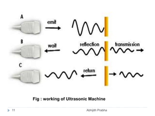 Fig : working of Ultrasonic Machine
11 Abhijith Prabha
 