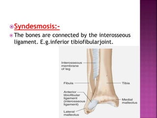 Syndesmosis:-
 The bones are connected by the interosseous
ligament. E.g.inferior tibiofibularjoint.
 