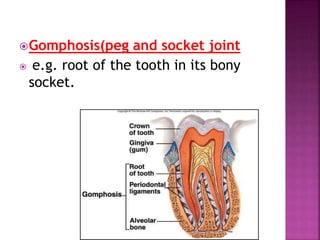 Gomphosis(peg and socket joint
 e.g. root of the tooth in its bony
socket.
 