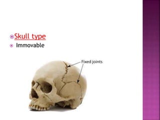 Skull type
 Immovable
 
