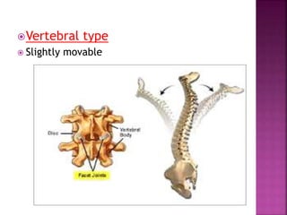 Vertebral type
 Slightly movable
 