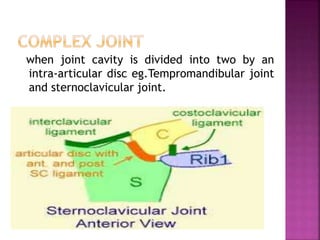 when joint cavity is divided into two by an
intra-articular disc eg.Tempromandibular joint
and sternoclavicular joint.
 