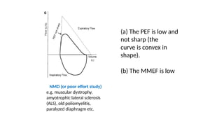 Poor Pef Graph Comprehensive Overview of Pulmonary Function Testing and Spirometry ...