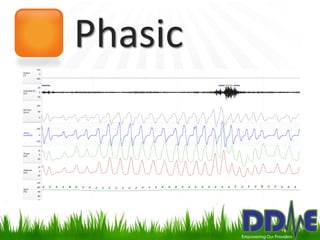 Phasic
 