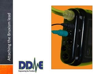 Attaching the Bruxism lead
 