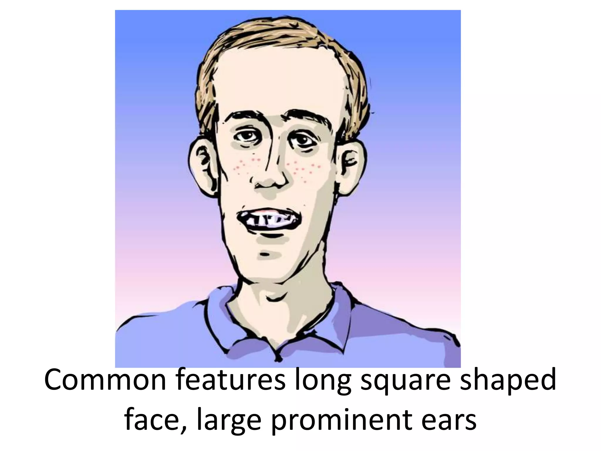 Common features long square shaped face, large prominent ears