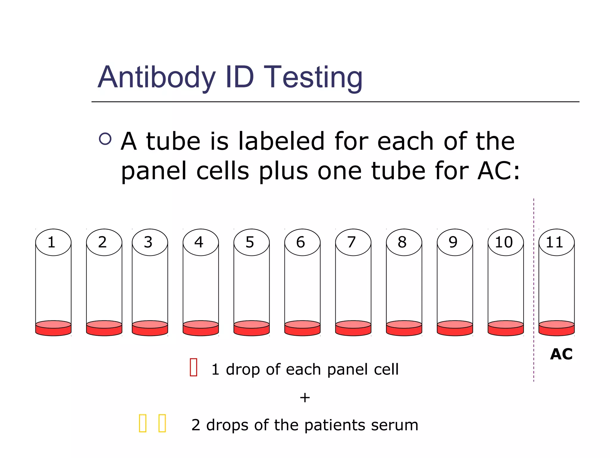Antibody ID Testing
 A tube is labeled for each of the
panel cells plus one tube for AC:
AC
1 2 3 4 5 6 7 8 9 10 11
 1 drop of each panel cell
+
2 drops of the patients serum 
 