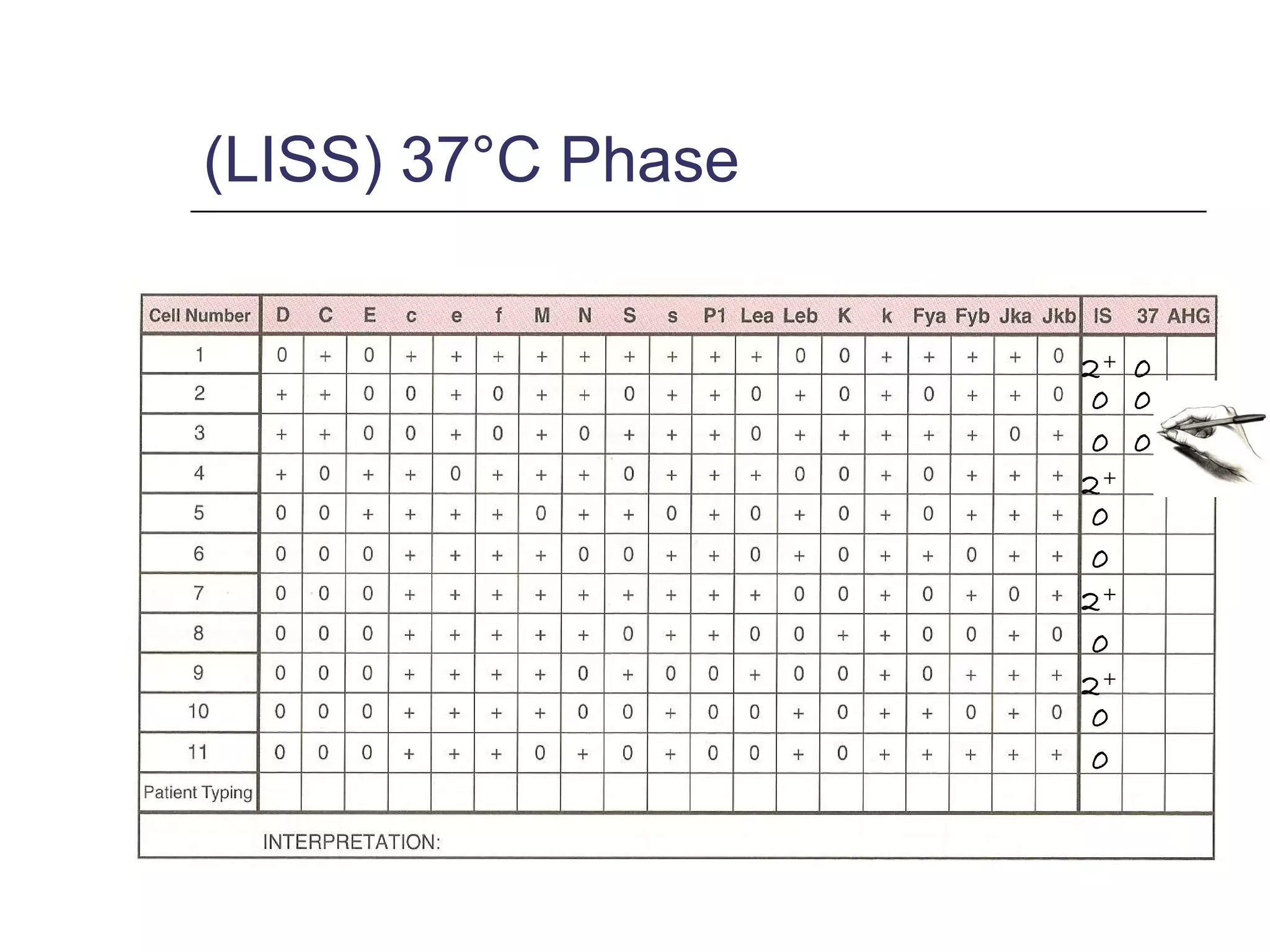 (LISS) 37°C Phase
2+
0
0
2+
0
0
2+
0
0
2+
0
0
0
0
 